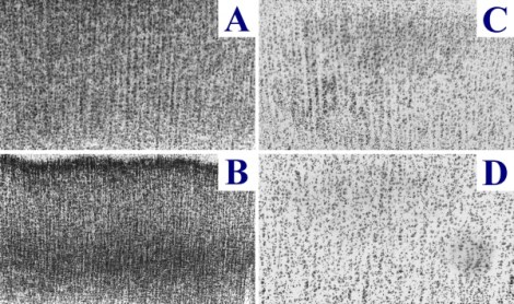 autism-pamphlet-fig3