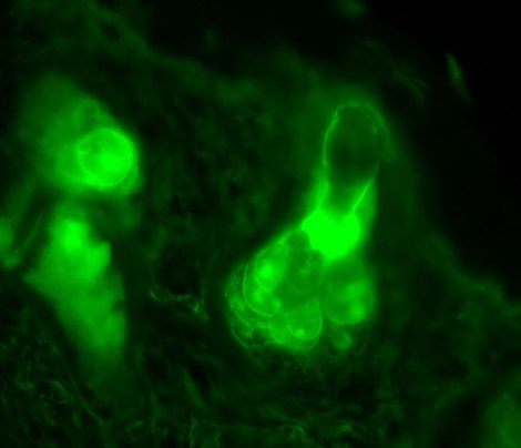 11_NG-DTG-P58_EAR_SOX9_40x_cropped