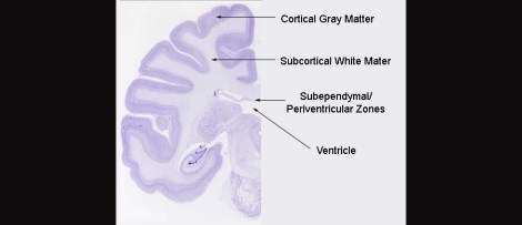 nissl_stain_of_the_brain1327292796325 copy