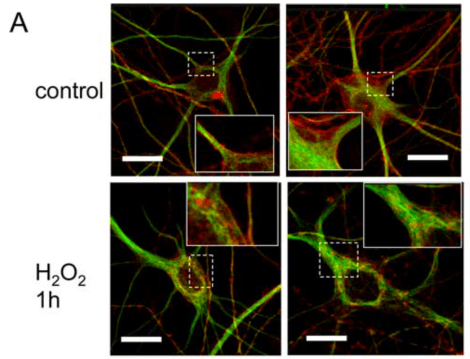 Screen Shot 2015-03-08 at 8.32.12 PM
