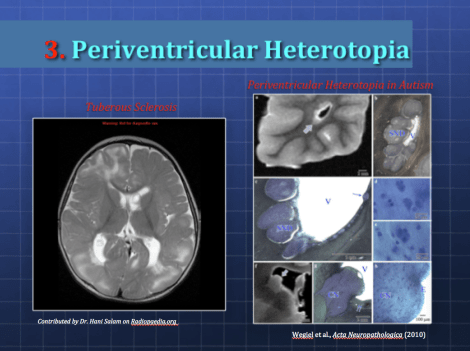 Screen Shot 2015-05-24 at 8.38.58 PM