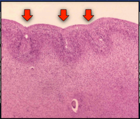 Screen Shot 2015-05-24 at 8.46.06 PM