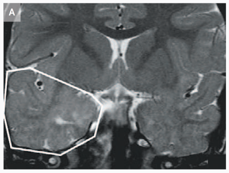 Screen Shot 2016-03-27 at 5.03.07 PM