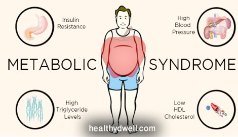 Metabolic-Syndrome-definition