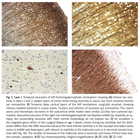 Screen Shot 2016-12-11 at 6.44.03 PM.png