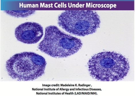 human-mast-cells-microscope.jpeg