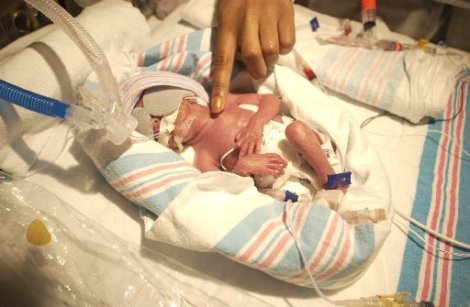premature-babyjpg-bf129670ff49a445